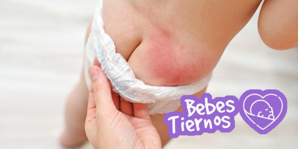 Cómo prevenir la dermatitis del pañal